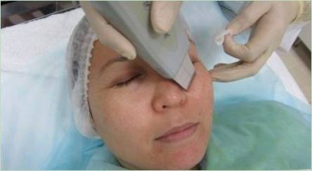 Pravidlá pre ultrazvukové čistenie tváre